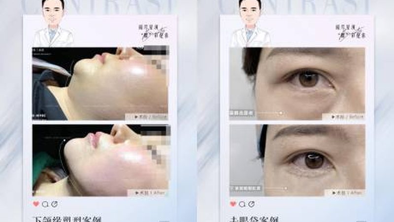注射美容：揭秘禁忌症与适应症**