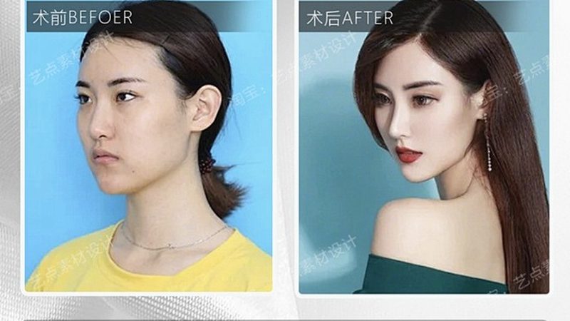 小标题：皮肤美容方案定制，从了解自身需求开始