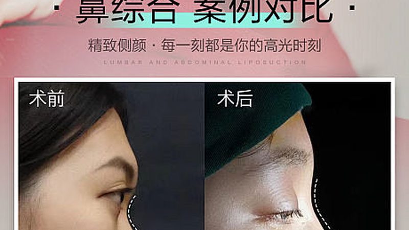 水光针后恢复期，护肤品选择有讲究