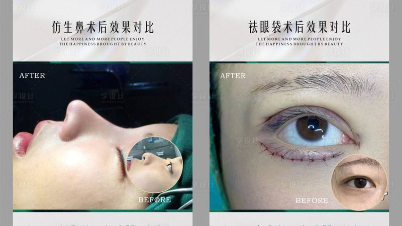 医美恢复期疼痛管理：有效缓解策略全解析