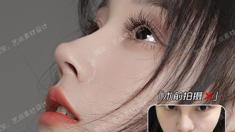 激光祛雀斑的价格差异到底藏在哪里