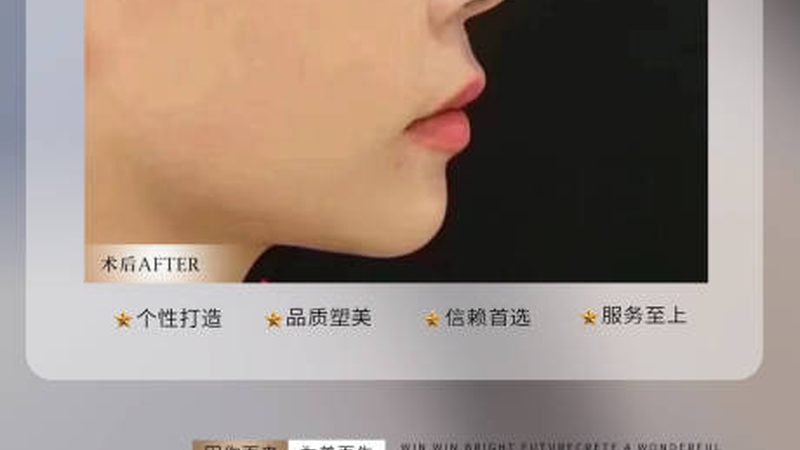 年轻人做隆鼻手术风险大吗