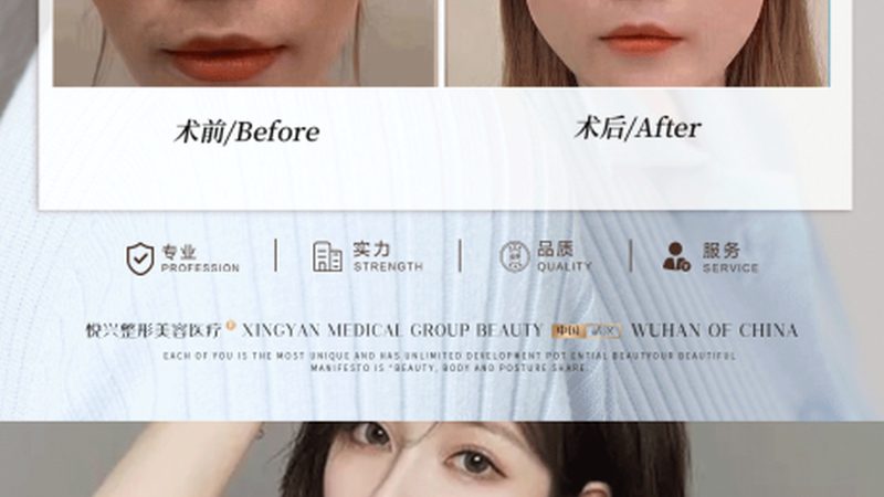 医美咨询师标准服务流程揭秘：专业护航，美丽无忧