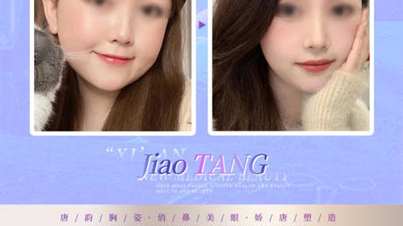 微整形VS手术整形：揭开两者之间的神秘面纱**