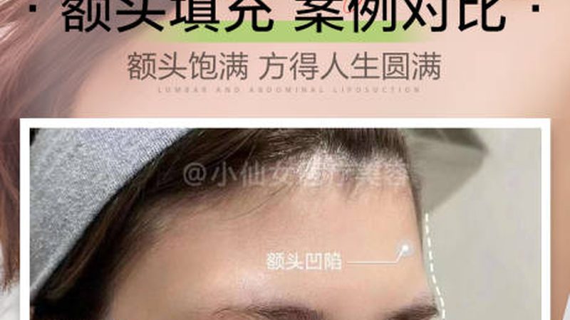 光子嫩肤与激光祛斑：价格背后的技术解析